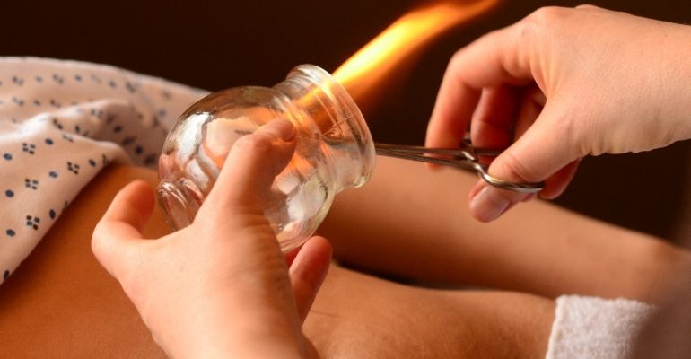 Benefícios e como fazer o tratamento de ventosaterapia